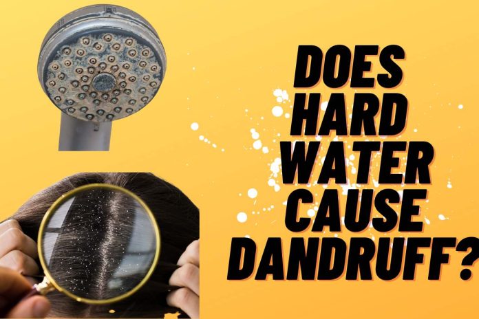 Does Hard Water Cause Dandruff